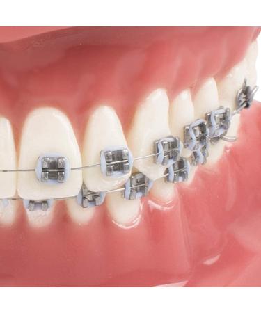 BAUR Dental Organ Model - Orthodontic Teeth Model for Dentists | Metal & Ceramic Oral Demonstration - Buy Online on GoSupps.com
