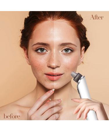 Blackhead Remover Black Head Remover for Face Whitehead Acne Remover with 6 Suction Power 4 Probes and LED Display Deep Cleansing Unclogging Pores Blackhead Remover Tool - Buy Online on GoSupps.com