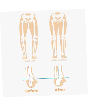 Buy Leg Correction Pads - Reflexology Insoles for Plantar Feet Orthotic Shoe Inserts & Cushions - Improve Foot Comfort & Heel Support - Buy Online on GoSupps.com