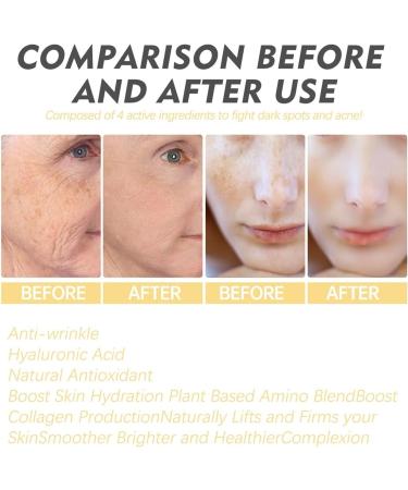 Freckle Repair Essence Anti-Wrinkle Rejuvenation Whitening Skin Fades Facial Wrinkles Fine Lines Spots 30ml - Buy Online on GoSupps.com