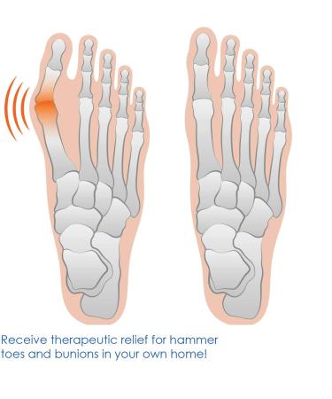 Buy Bunion Corrector Strap | Orthopedic Toe Straightener & Pain Relief for Hallux Valgus | International Shipping Available - Buy Online on GoSupps.com