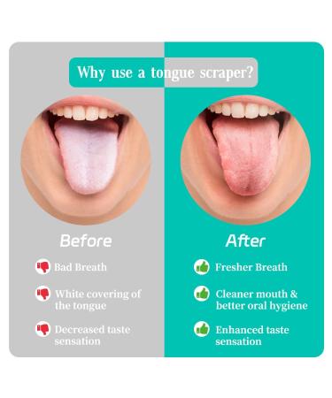 VIWIK 6 Pack Stainless Steel Tongue Scrapers for Adults | Easy-to-Use Tongue Cleaners for Oral Care & Bad Breath Reduction - Buy Online on GoSupps.com