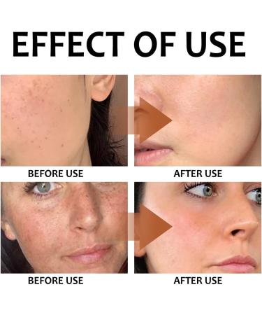 Kojic Acid Toner Suitable for All Skin Type Gylcolic Acid Glycolic Acid 7% Toner Skincare Hydrating Toner Brighten Rejuvenate Moisturize & Strengthen Your Skin - Buy Online on GoSupps.com