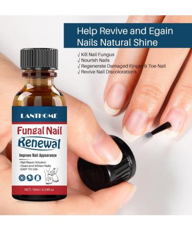 Nail Treatment Repair Toe Nail Repair Treatment Extra Strength Toenail Repair Solution Nail Renewal Liquid For Discoloration Nail & Toenails(10ML) - Buy Online on GoSupps.com