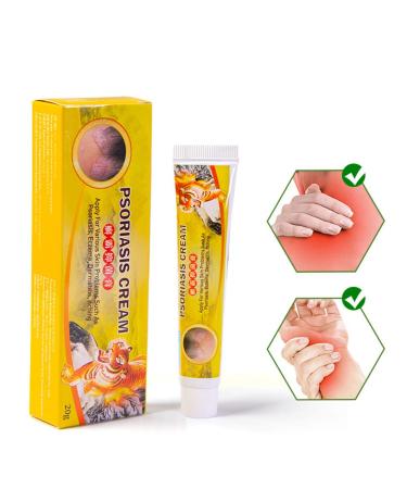 Worglo Ultimate Psoriasis Relief Cream Acid to Help Control Reoccurrences of Psoriasis Symptoms Helps Irritated Itching Scaling Skin Feel Soothed and Comfortable