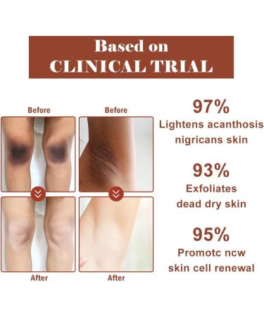 Fengyang Exfoliating Oil Nourishing Moisturizing Exfoliating Oils Yellow Peeling Oil Body Peeling Oil for Skin Lightening Moisturizing Removes Dead Skin Cells - Buy Online on GoSupps.com