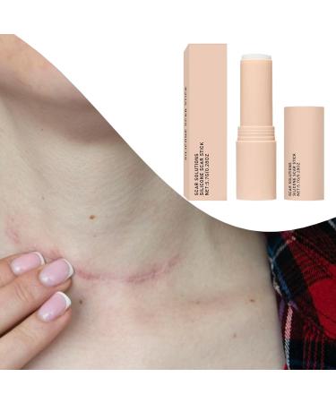Stick R paration Cicatrice Cr me R paratrice pour Cicatrices Cutan es | Soin Apaisant et Nourrissant pour R cup ration Apr s C sarienne Br lures paules Bras Jambes - Buy Online on GoSupps.com