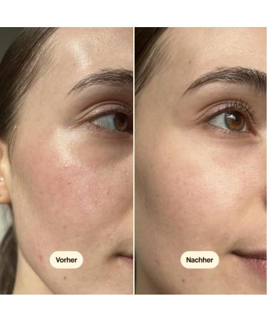 Freshly Cosmetics Moisturizing day cream for dry and sensitive skin Bloom Orchid Face Cream 50ml - Buy Online on GoSupps.com