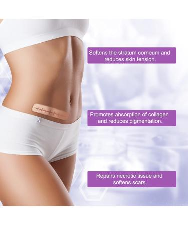 Soothing Silicone Scar Sheets Roll for C-Section, Surgery, Burns, Acne, Stretch Marks - 1.6 x 120 in - Reusable & Effective - Keloid Reduction - Buy Online on GoSupps.com