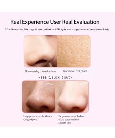 zroven 5.0MP 20X LCD Display WIFI Intelligent Visual Blackhead Remover Electric Blackhead Removal Instrument Household Pore Cleaner with Three Modes Six Tips Six Adjustable LED Lights - Buy Online on GoSupps.com