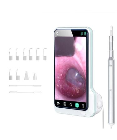 SUOTENG Ear Cleaner Digital Otoscope Ear Canal Endoscope 1080P HD Otoscope Camera with Earwax Removal Tools for Children and Adults Can Effectively Accurately and Comfortably Remove Earwax