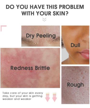 Snail Mucin 97% Misting Toner - 100 mL | Korean Skincare for Ultimate Hydration & Nourishment | Shop Internationally - Buy Online on GoSupps.com