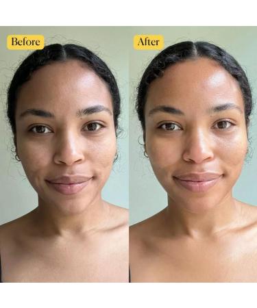 Turmeric Oil with Rosemary - Brightening & Moisturizing Facial Oil | Skincare | 2 fl. oz - International Shipping - Buy Online on GoSupps.com