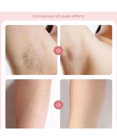 DuskOfficial 2-in-1 Electric Razor for Women | All-Body Use Shaver in Blue - International Shipping Available - Buy Online on GoSupps.com