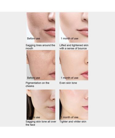 rongweiwang Anti-wrinkle Face Serum Evening Whitening Essence Anti-Aging Acne Corrector Moisturizing Firming Skin Care Products Whitening Essence - Buy Online on GoSupps.com