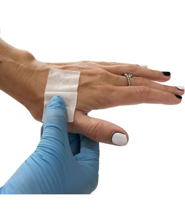 Rescue Essentials Sting Relief Wipes - 10 Pack | Fast Soothing Relief - Buy Online on GoSupps.com