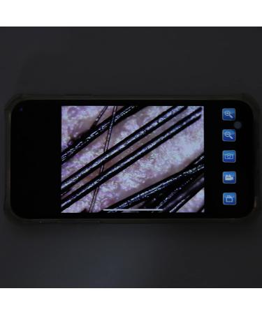 100X Magnification Skin Hair Scalp Detector | 2MP Camera Skin Health Analyser for Home & Salon Use - Buy Online on GoSupps.com