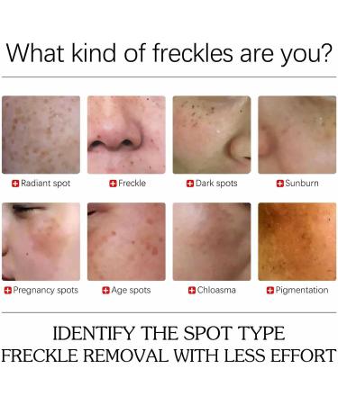  Hongjingda Turmeric - Liquid Dark Spot Removal | 1.01 FL oz Rejuvenating Skin Care for Women Moisturizes Dull and Dry Skin - Buy Online on GoSupps.com