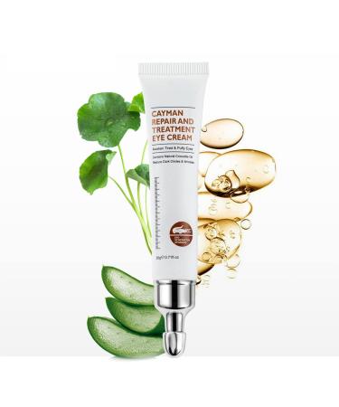 Feeke Magic Eye Cream  Instantly Remove Under Eye Bags Wrinkles Puffiness Dark Circles and Fine Lines  Anti Aging Eye Cream 1PC