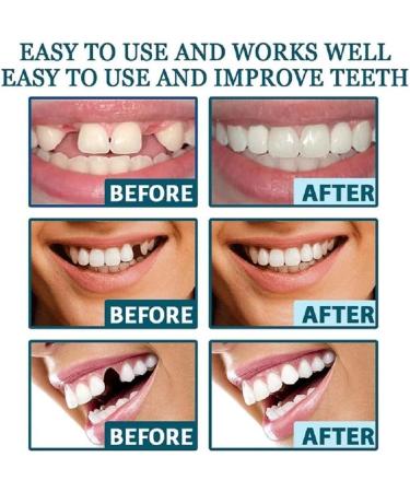 2 Pairs Regain Confidence Smile for Women and Men Temporarily Adjustable(White) - Buy Online on GoSupps.com