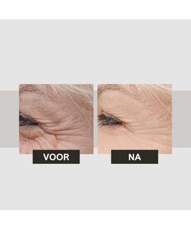 Peer Pharm LTD Ageless AntiAging Moisturizing Cream with Caviar Extract Corrects and Lightens Vitamins C and E Collagen Dead Sea Minerals 50ml - Buy Online on GoSupps.com