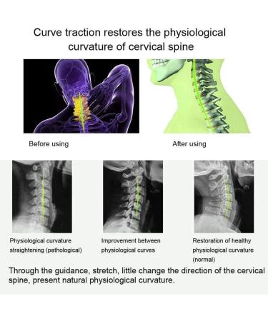 Safwel Cervical Traction Brace - Adjustable Neck & Spine Support for Pain Relief | Comfortable Cervical Traction Device - Buy Online on GoSupps.com