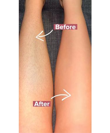 Crystal Hair Eraser - Nano Painless Hair Removal Tool for Men and Women | Fast & Easy Exfoliation Stone | Soft Smooth Silky Skin | Nail Filer Included | Rose Red - Buy Online on GoSupps.com