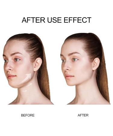 APPTI Rose Collagen V-Line Shaping Face Mask for Women - Double Chin Reducer & Neck Slimmer - Buy Online on GoSupps.com
