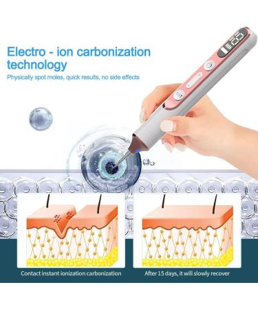 HpLNDas Plasma Pen Needle Set Skin Flap Removal Pen 19 Intensity Levels and LED Light with Replaceable Needle for Face Body Warts Freckles Nevus Age Spots - Buy Online on GoSupps.com