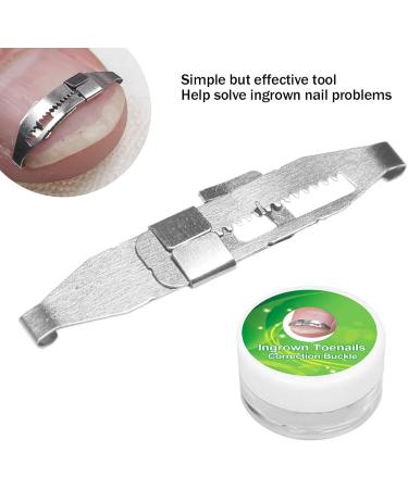 Brand Ingrown Toenail Corrector Stainless Steel Pencil Paronychia Treatment Tool for Foot Care - Buy Online on GoSupps.com