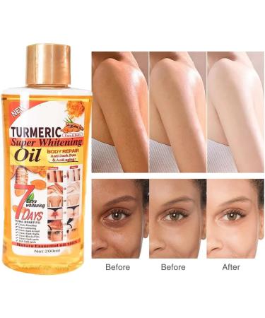 Soft Oil 7 Turmeric Oil Soft 7 Soft 7 Oil Honey Turmeric Soap Bar Soft 7 Turmeric Oil for Skin Veetgold Body Oil Turmeric Body Oil (1PCS) - Buy Online on GoSupps.com