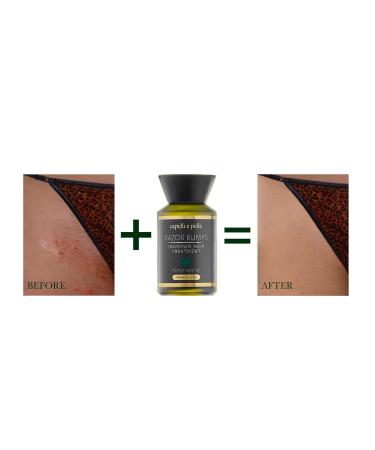 Ingrown Hair Treatment 130ml with Hemp Seed Oil - Razor Bumps & After Shaves Solution - Buy Online on GoSupps.com