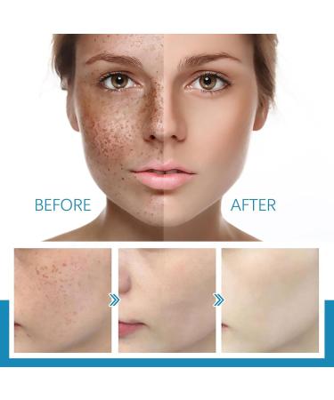  Miake Firming facial essence 10 ml facial care with firming effect for all skin types men and women Miake - Buy Online on GoSupps.com