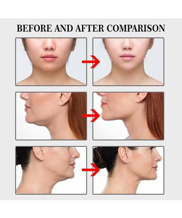 Invisible Face Lift Tape - 40 Pcs, Ultra-Thin & Waterproof Face Lifting Tools for Wrinkle-free Skin - Buy Online on GoSupps.com