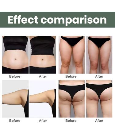 Wormwood Fat Burning Cream - Slimming Gel for Weight Loss Cellulite Reduction & Skin Firming (30g) | Soothing Relaxing Tightening Formula | International Shipping Available - Buy Online on GoSupps.com