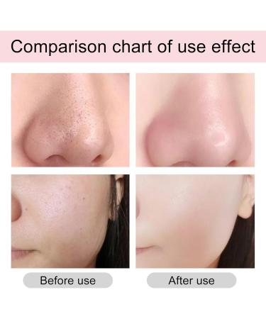 AHA 30%+BHA 2% Face Serum Dark Spot Remover for Face Face Serum for Women Brightening Serum Peeling Serum Solution Anti Aging Serum for Face Smooth Skin Exfoliating Reduce Fine Line Moisturiser Face - Buy Online on GoSupps.com