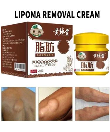 Wokii 3PCS Lipoma Removal Cream Lipoma Treatment Huangfutang Lipoma Removal Miaozu Huangfutang Lipoma Removal Cream Safe and Effective - Buy Online on GoSupps.com