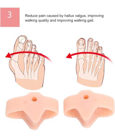 Ball Toe Corrector | Bale Adjuster for Improved Comfort & Walking Quality | Ideal for Travel & Home Use - Skin Color Durable Design - Buy Online on GoSupps.com