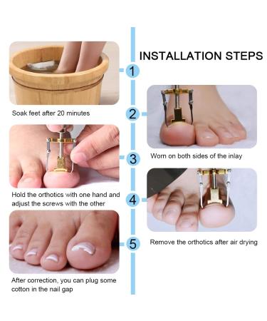 Ingrown Toenail Corrector & Lifter - Professional Toe Clamp for Effective Treatment - Buy Online on GoSupps.com