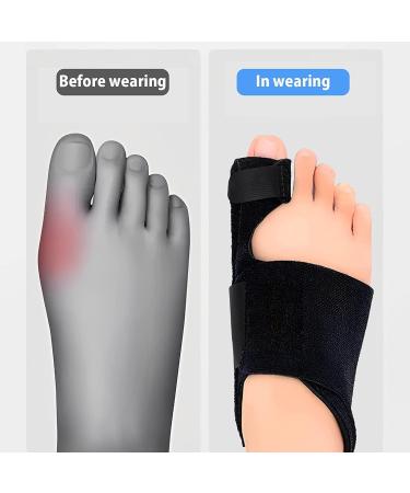 Drucixy Bunion Corrector for Women and Men - Toe Separators for Pain Relief - Big Toe Separator Spacers and Straighteners - Exercise Strap for Hallux Valgus - Buy Online on GoSupps.com