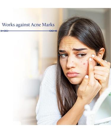 Blue Nectar Plum Face Serum for Acne and Marks | Oil-Free Solution for Oily Skin | Minimize Pores & Smooth Texture (8 Herbs 30ml) - Buy Online on GoSupps.com