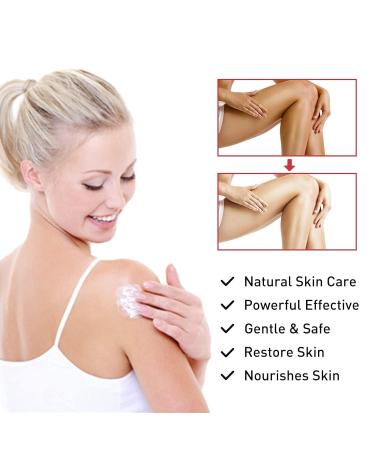 Intimate Area Cream for Dark Skin - Brightening Cream for Underarms & Sensitive Areas | 30ML | Skin Lightening Solution - Buy Online on GoSupps.com