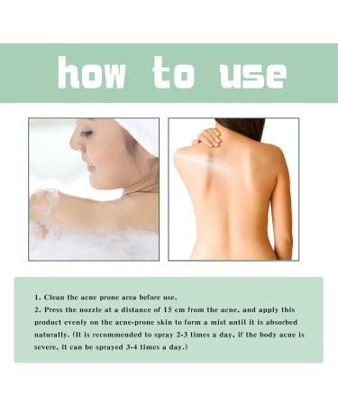 Acne Treatment Spray Lighten Acne Marks Skin Care Spray Herbaluxy Back Acne Treatment Body Moisturiser For Dry Skin Repair Back Shoulder Acne & Body Acne & Chest Acne & Butt Acne Gentle - Buy Online on GoSupps.com