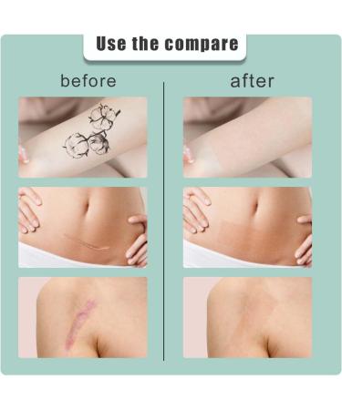 Bio Skin Tone Protect Fix pour marquer les marques - M lange sans couture - Tissu non tiss ventil - Hypoallerg nique - Confortable porter - Buy Online on GoSupps.com