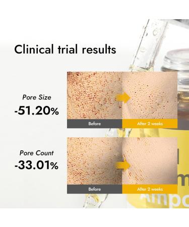  MIZON REAL VITAMIN C AMPOULE (30ml) Korean Skincare - Pure Vitamin C (19%) Brightening Serum - Complexion Correction - Nutrition & Hydration - Natural Ingredients - Buy Online on GoSupps.com