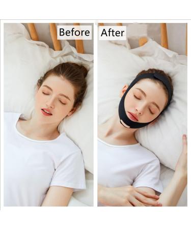 Anti Snoring Chin Strap - Effective Stop Snoring Device for Men and Women - Breathable & Adjustable - Snore Reduction Solution - Better Sleep - Black - Buy Online on GoSupps.com
