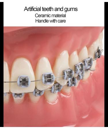 Dental Model Dentist Orthodontic Teeth Demonstration Model Orthodontic Dental Model with Ceramic Brackets and Metal Bracket for Learning Teaching Research - Buy Online on GoSupps.com