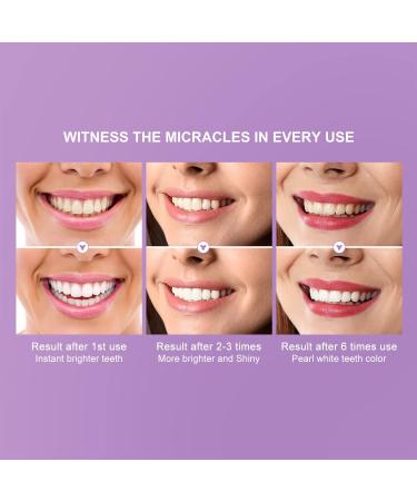 Teeth Whitening Kit - Enamel Safe for Whiter Teeth - Includes Booster, Brightener & Prolonger - Restore Enamel & Brighten Teeth - Buy Online on GoSupps.com