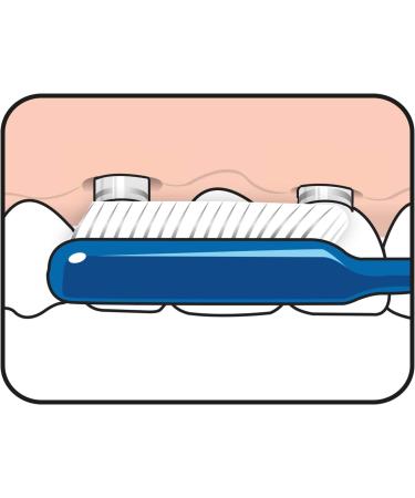 TePe Implant & Jaw-Friendly Toothbrush Pack of 3 - Ideal for Sensitive Teeth | International Shipping - Buy Online on GoSupps.com