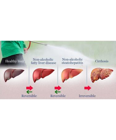 ORGANIZE HEPTAWIT AYURVEDIC liver syrup for complete healthy liver protection 150 ML - Buy Online on GoSupps.com
